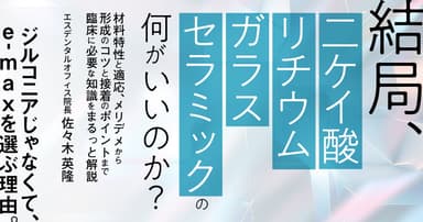 結局、「二ケイ酸リチウムガラスセラミック」の何がいいのか？
