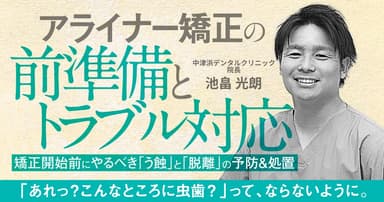 アライナー矯正の前準備とトラブル対応