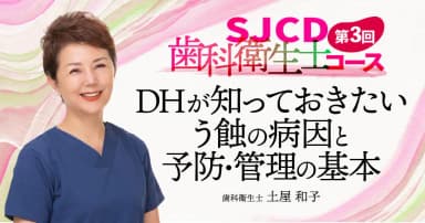 【第3回】DHが知っておきたいう蝕の病因と予防・管理の基本