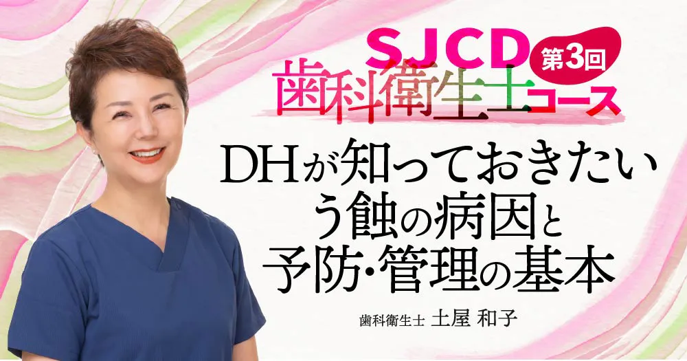 【第3回】DHが知っておきたいう蝕の病因と予防・管理の基本