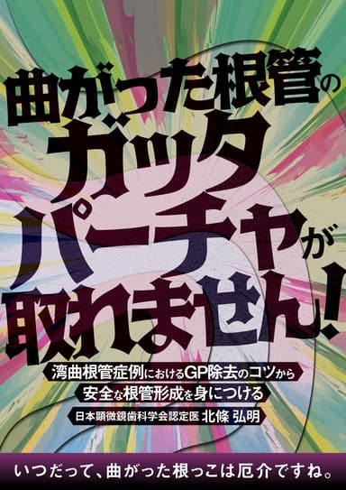 ランキング3位の曲がった根管のガッタパーチャが取れません！