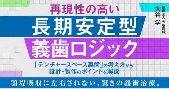 再現性の高い長期安定型義歯ロジック