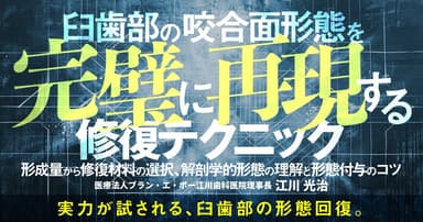 臼歯部の咬合面形態を完璧に再現する修復テクニック