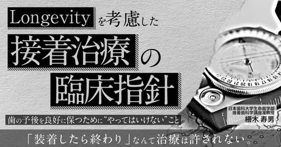 Longevityを考慮した接着治療の臨床指針