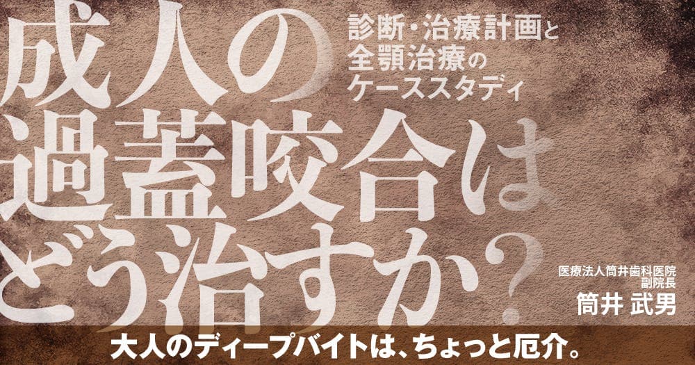 成人の過蓋咬合はどう治すか？