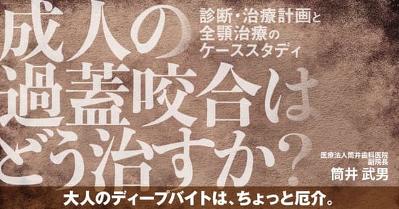 成人の過蓋咬合はどう治すか？