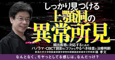 しっかり見つける上顎洞の異常所見