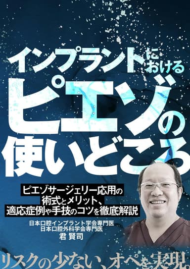 ランキング18位のインプラントにおけるピエゾの使いどころ