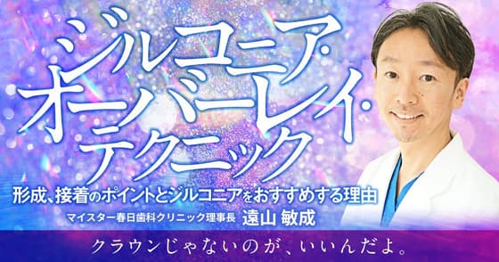 ジルコニア・オーバーレイ・テクニック