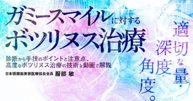 ガミースマイルに対するボツリヌス治療