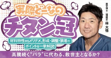 実際どーなの「チタン冠」