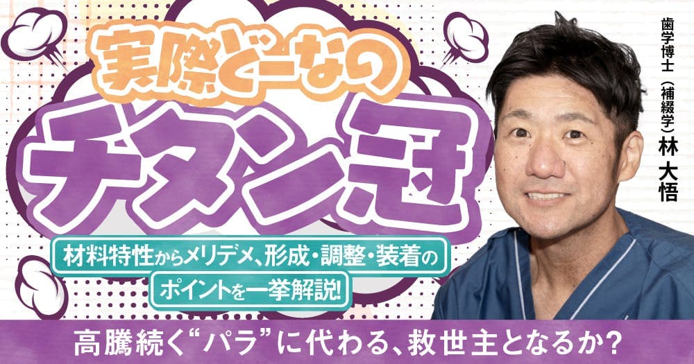 実際どーなの「チタン冠」