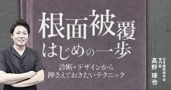 根面被覆はじめの一歩。歯根露出・歯肉退縮してしまったら。