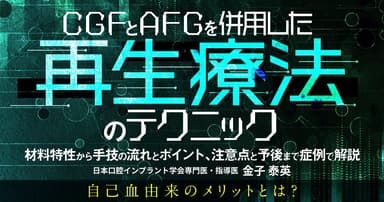 CGFとAFGを併用した再生療法のテクニック