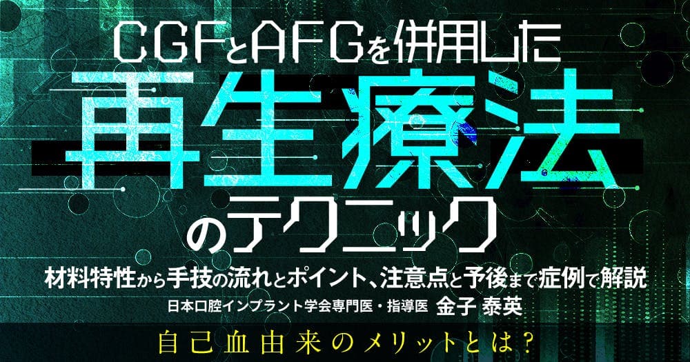 CGFとAFGを併用した再生療法のテクニック - 材料特性から手技の流れとポイント、注意点と予後まで症例で解説