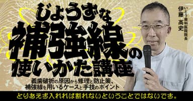 じょうずな「補強線」の使いかた講座