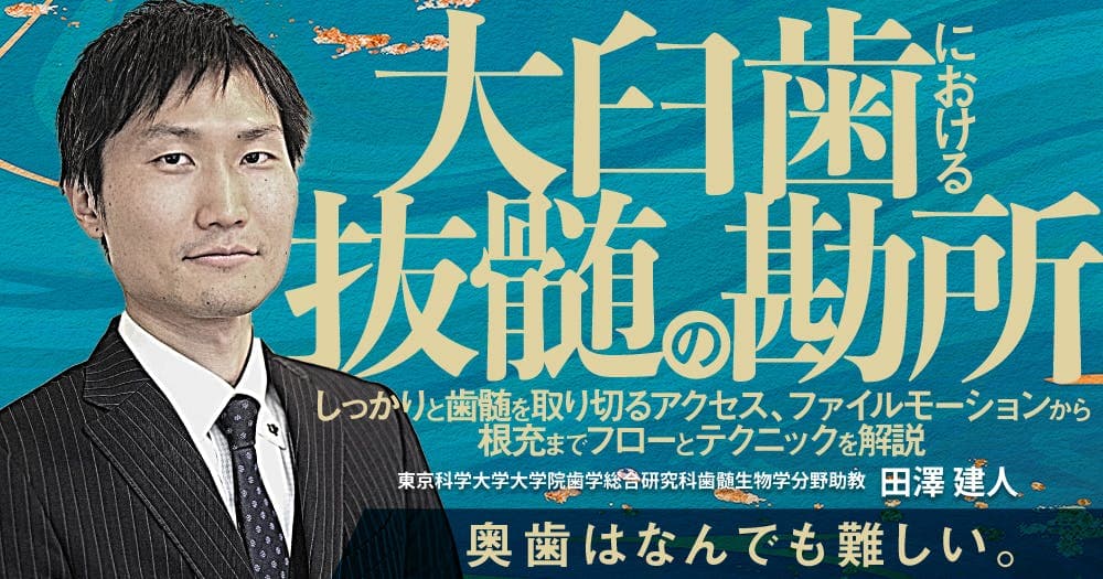 大臼歯における抜髄の勘所 - しっかりと歯髄を取り切るアクセス、ファイルモーションから根充までフローとテクニックを解説