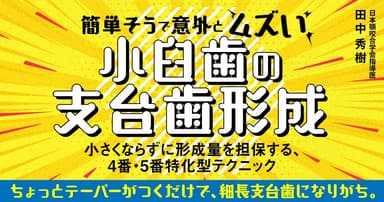 簡単そうで意外とムズい「小臼歯の支台歯形成」