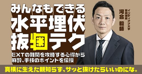 みんなもできる水平埋伏抜歯テク