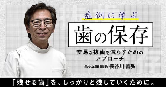 症例に学ぶ「歯の保存」