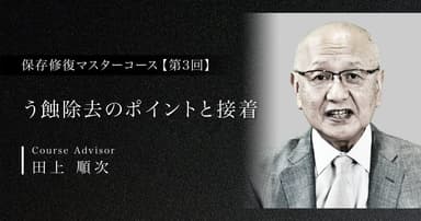 【第3回】う蝕除去のポイントと接着