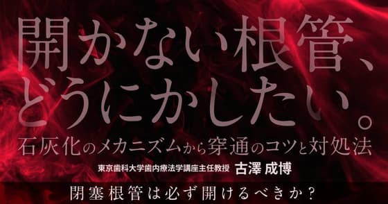 開かない根管、どうにかしたい。