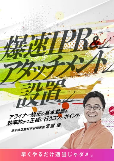 ランキング14位の爆速IPR&アタッチメント設置