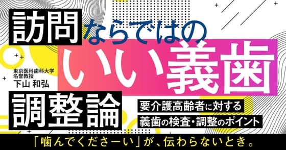 訪問ならではの「いい義歯」調整論