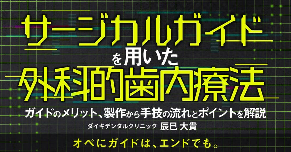 サージカルガイドを用いた外科的歯内療法