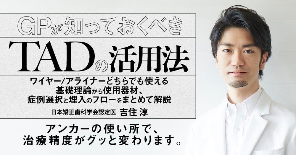 GPが知っておくべき「TAD」の活用法 - ワイヤー/アライナーどちらでも使える基礎理論から使用器材、症例選択と埋入のフローをまとめて解説