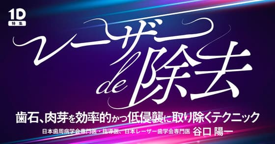 レーザーde除去