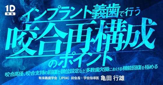 インプラント義歯で行う咬合再構成のポイント