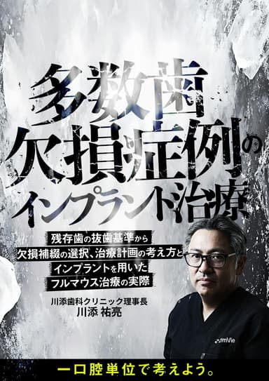ランキング8位の多数歯欠損症例のインプラント治療