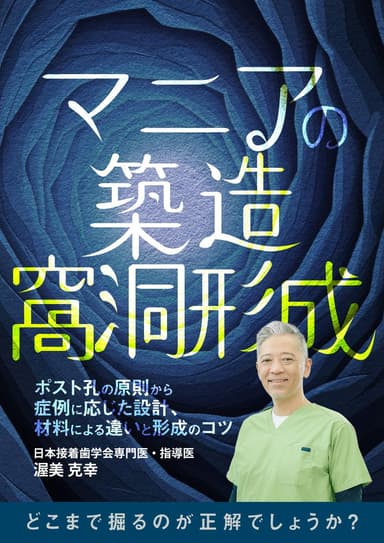 ランキング14位のマニアの築造窩洞形成