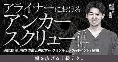 アライナーにおけるアンカースクリュー活用