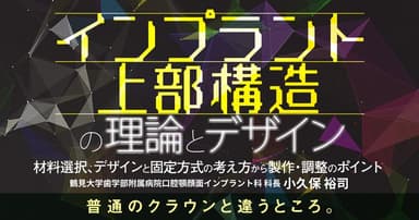 インプラント上部構造の理論とデザイン