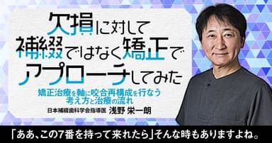欠損に対して補綴ではなく矯正でアプローチしてみた