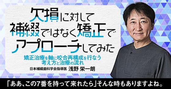欠損に対して補綴ではなく矯正でアプローチしてみた