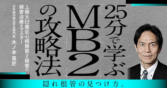 25分で学ぶ「MB2」の攻略法