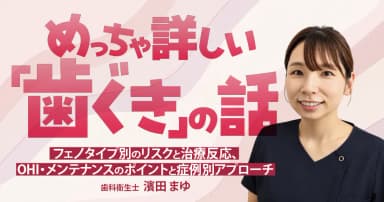 めっちゃ詳しい「歯ぐき」の話