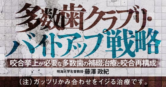多数歯クラブリ・バイトアップ戦略