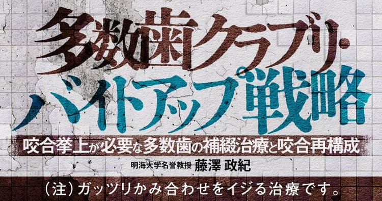 多数歯クラブリ・バイトアップ戦略