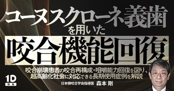 コーヌスクローネ義歯を用いた咬合機能回復