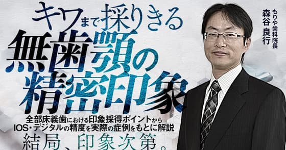 キワまで採りきる無歯顎の精密印象