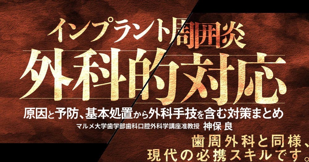 インプラント周囲炎の外科的対応 - 原因と予防、基本処置から外科手技を含む対策まとめ
