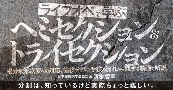 ライブオペで学ぶ「ヘミセクション&トライセクション」
