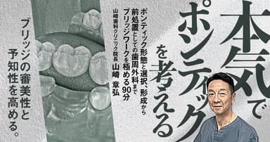 本気でポンティックを考える