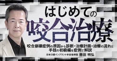 はじめての「咬合治療」