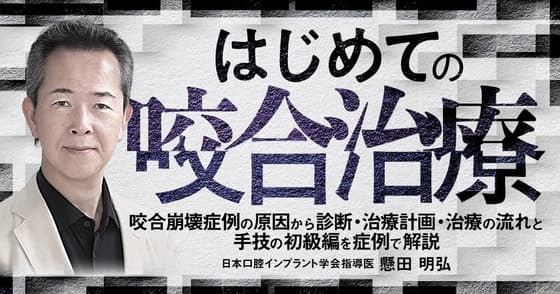 はじめての「咬合治療」