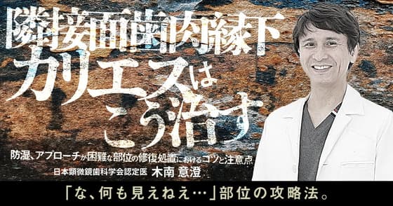 「隣接面歯肉縁下カリエス」はこう治す